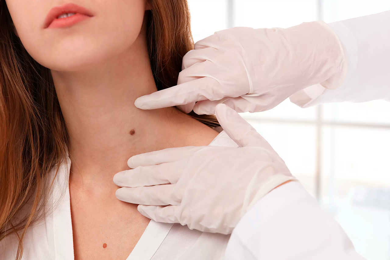 dermatologiya